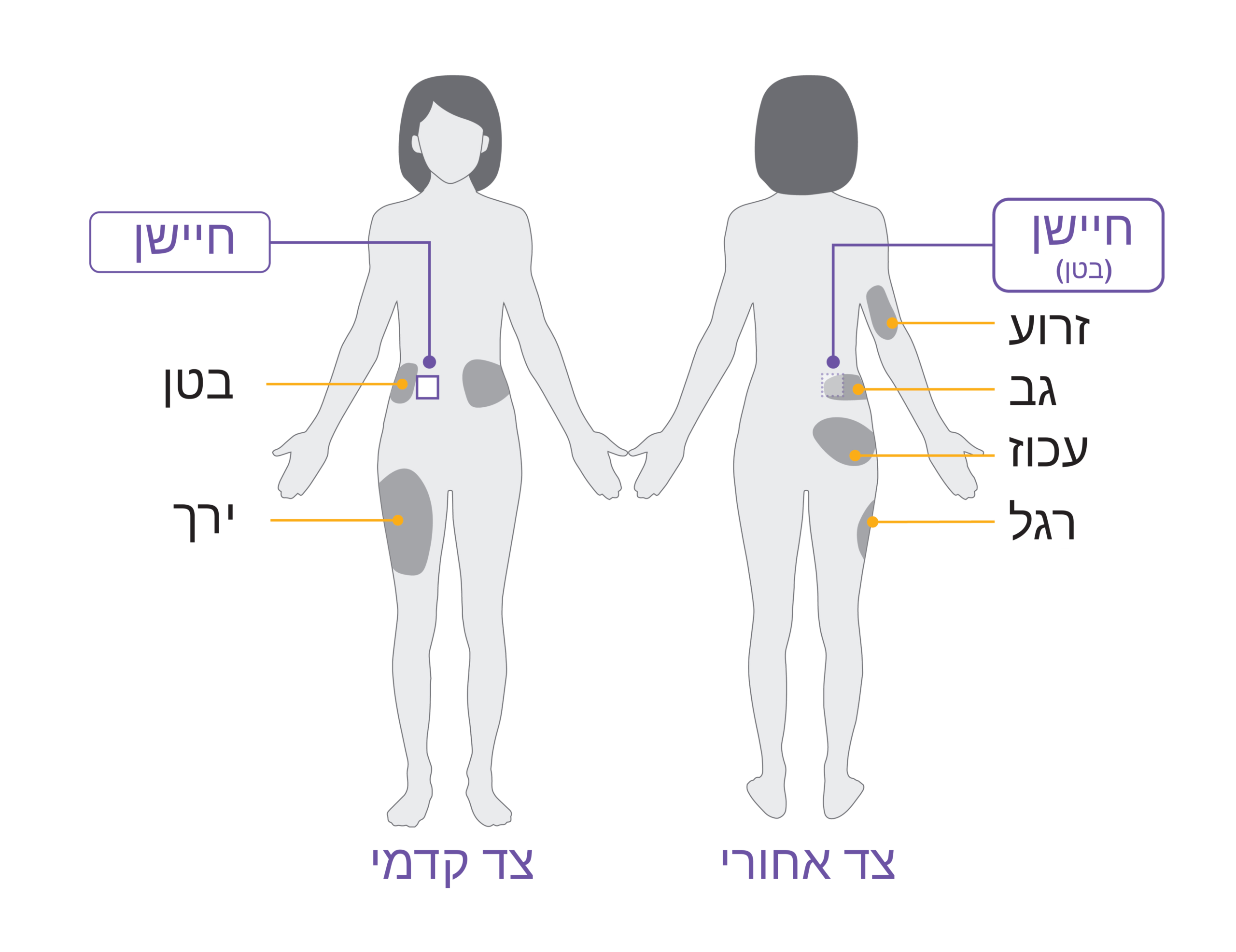 Pod placement diagram ADULT ABDOMEN