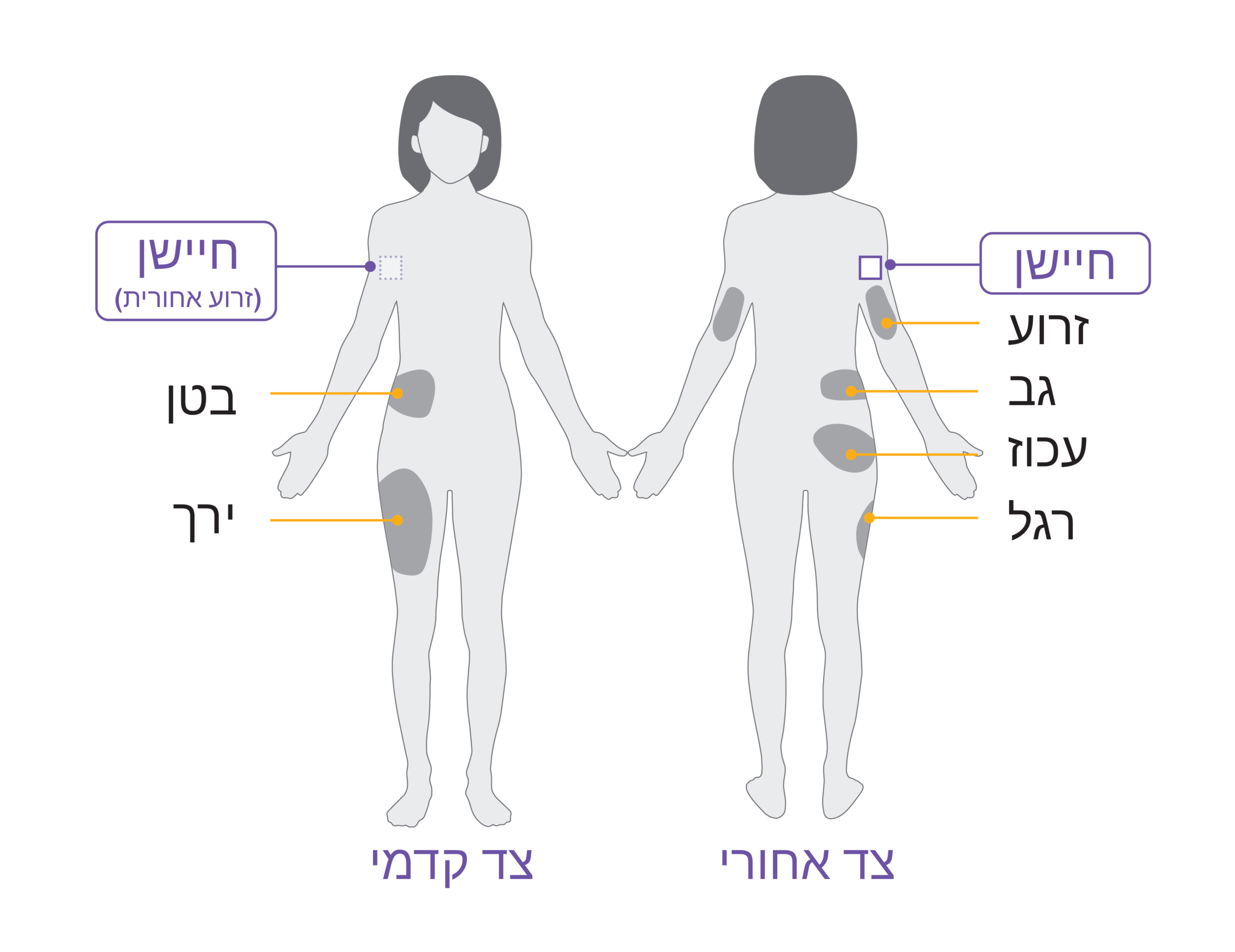 Pod placement diagram ADULT BACK OF ARM