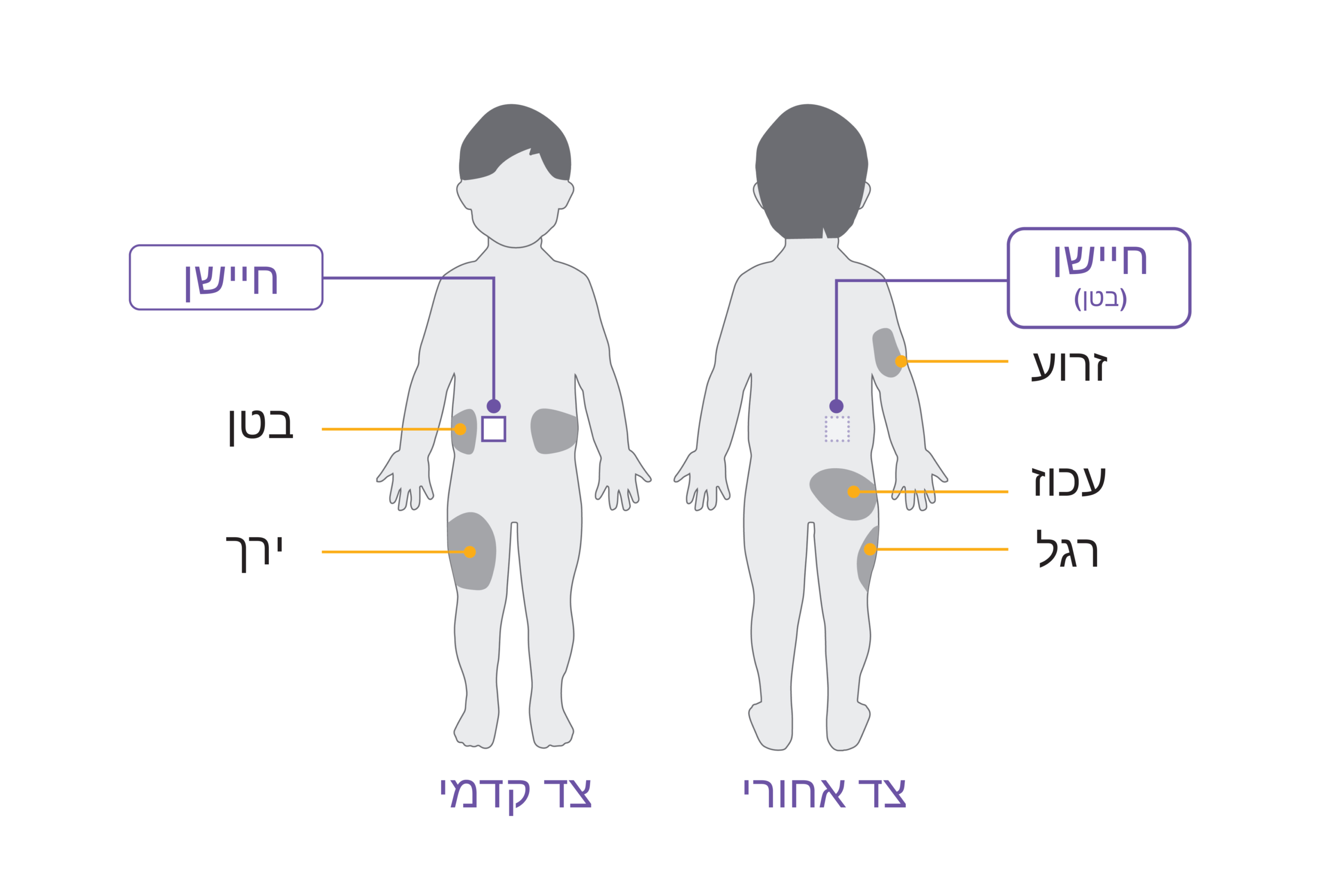 Pod placement diagram CHILD ABDOMEN